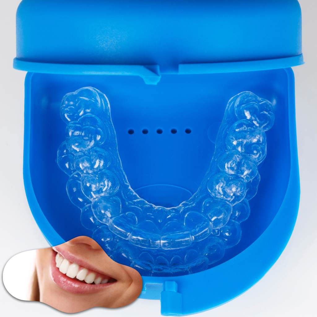 kor teeth whitening