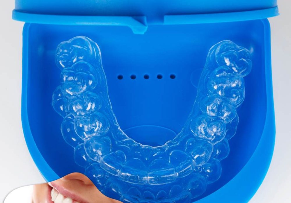 kor teeth whitening