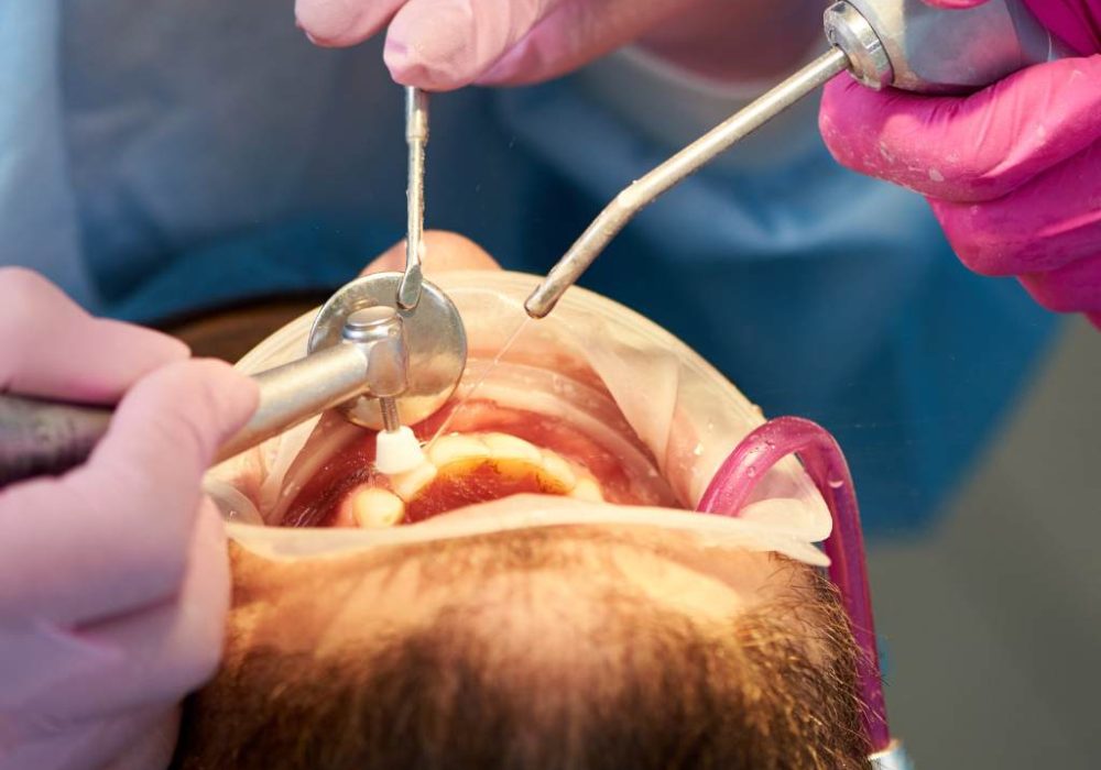 teeth implants jackson ms
